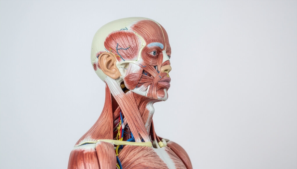 Anatomical model showing neck muscles and headaches referral patterns