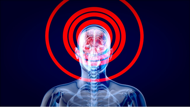 Pain Central Sensitisation Brain Injury Neck Head Spine