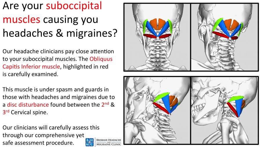 constant-headache-brisbane-headache-migraine-clinic